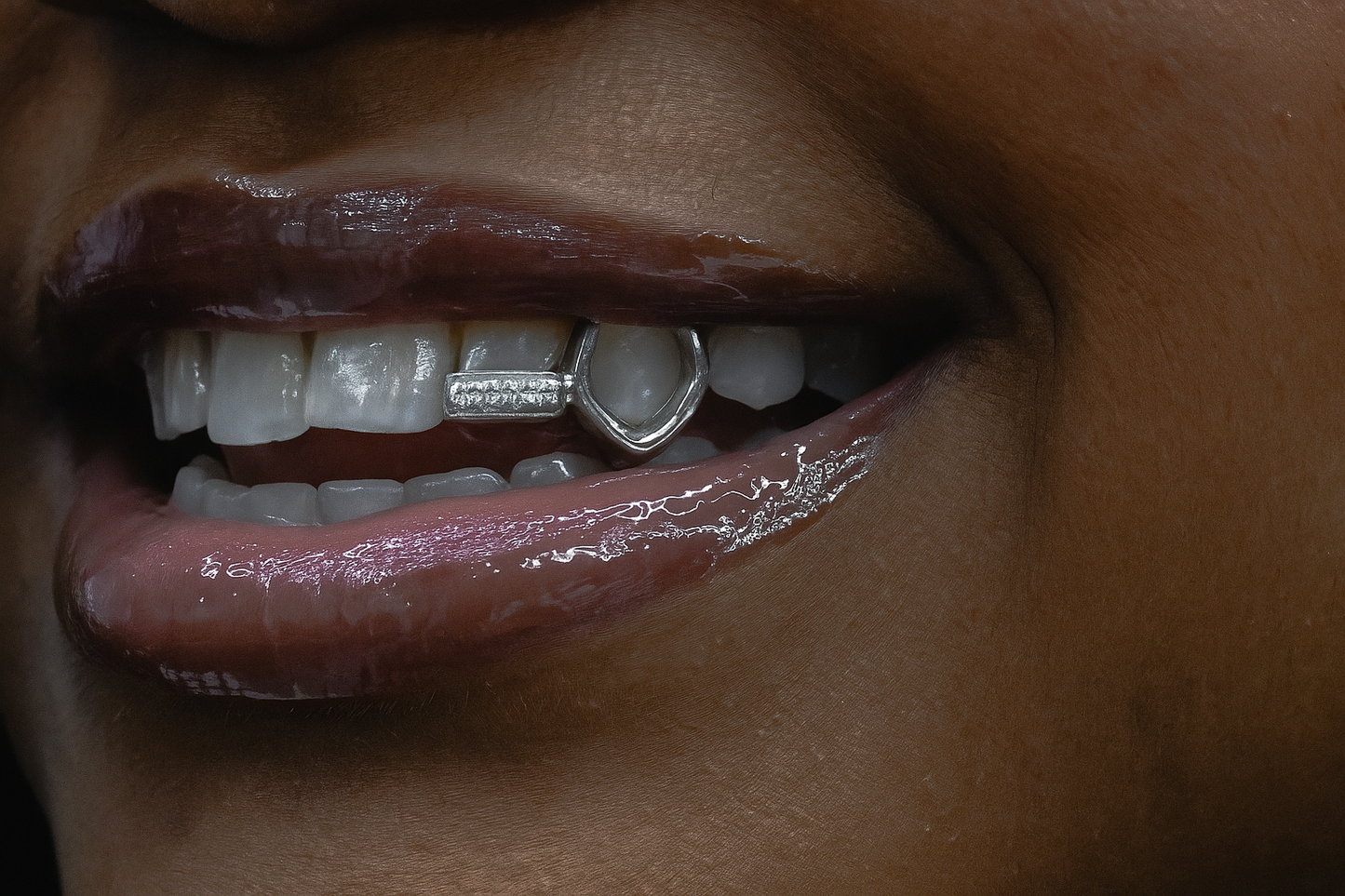 Open Face Grillz - Custom Teeth Grillz