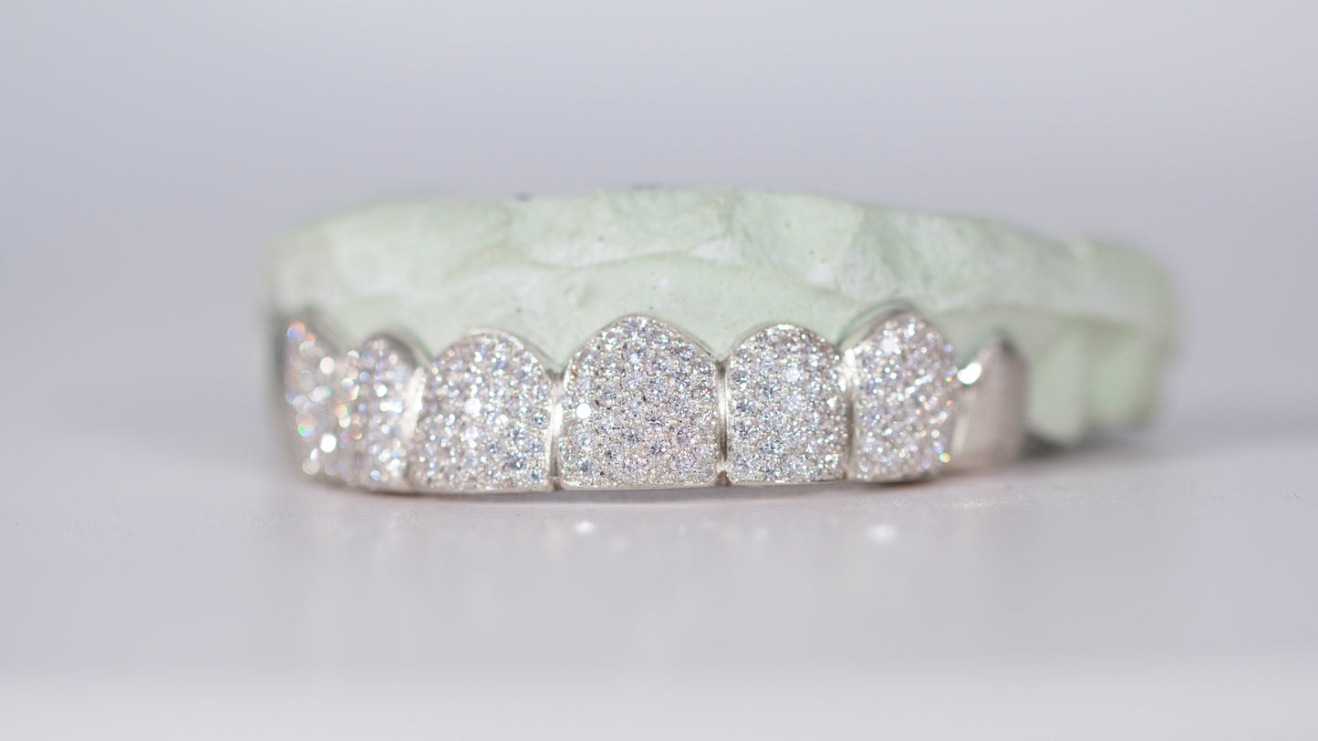 End Cap VVS Moissanite Diamond Grillz