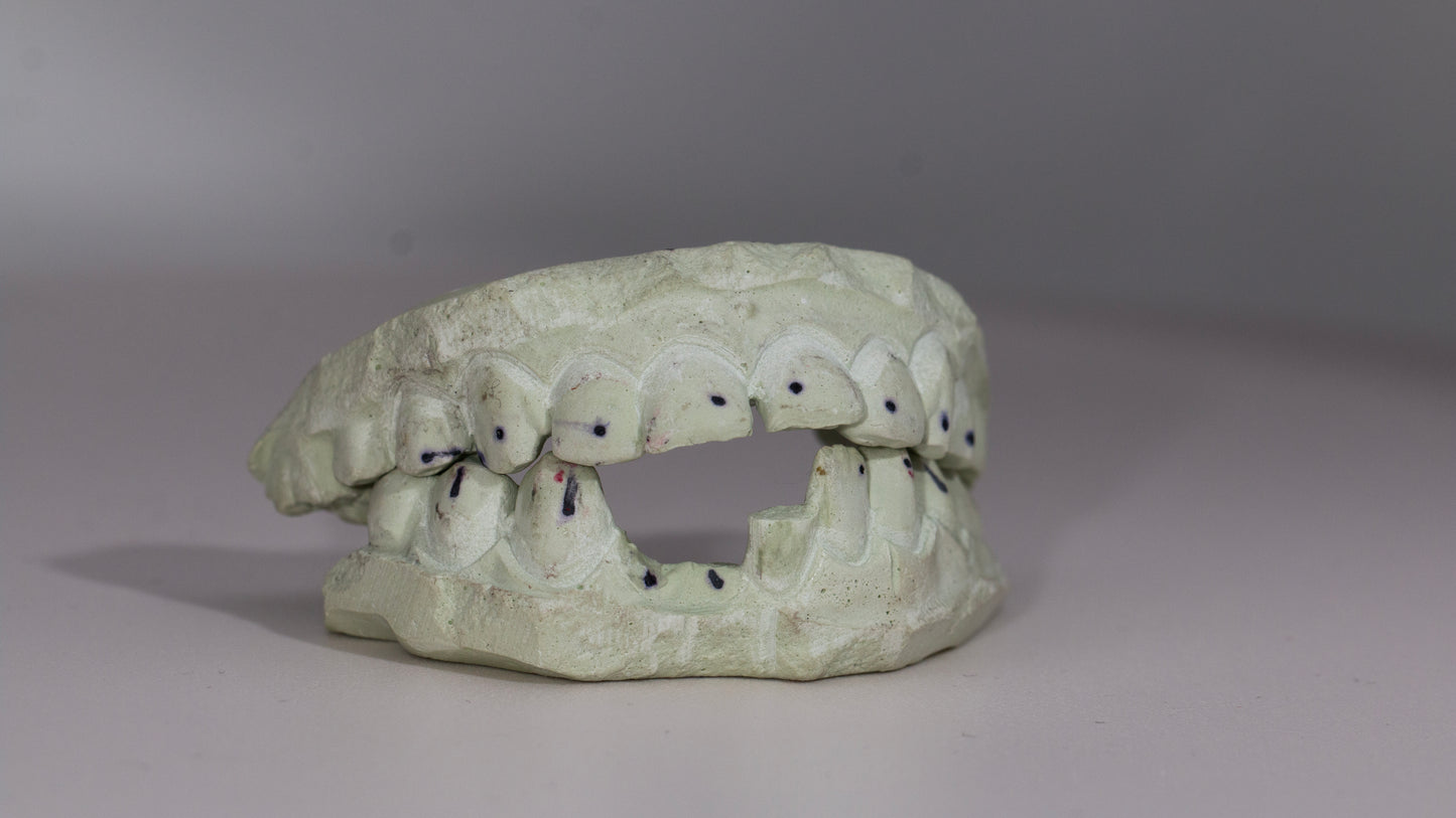 End Cap VVS Moissanite Diamond Grillz