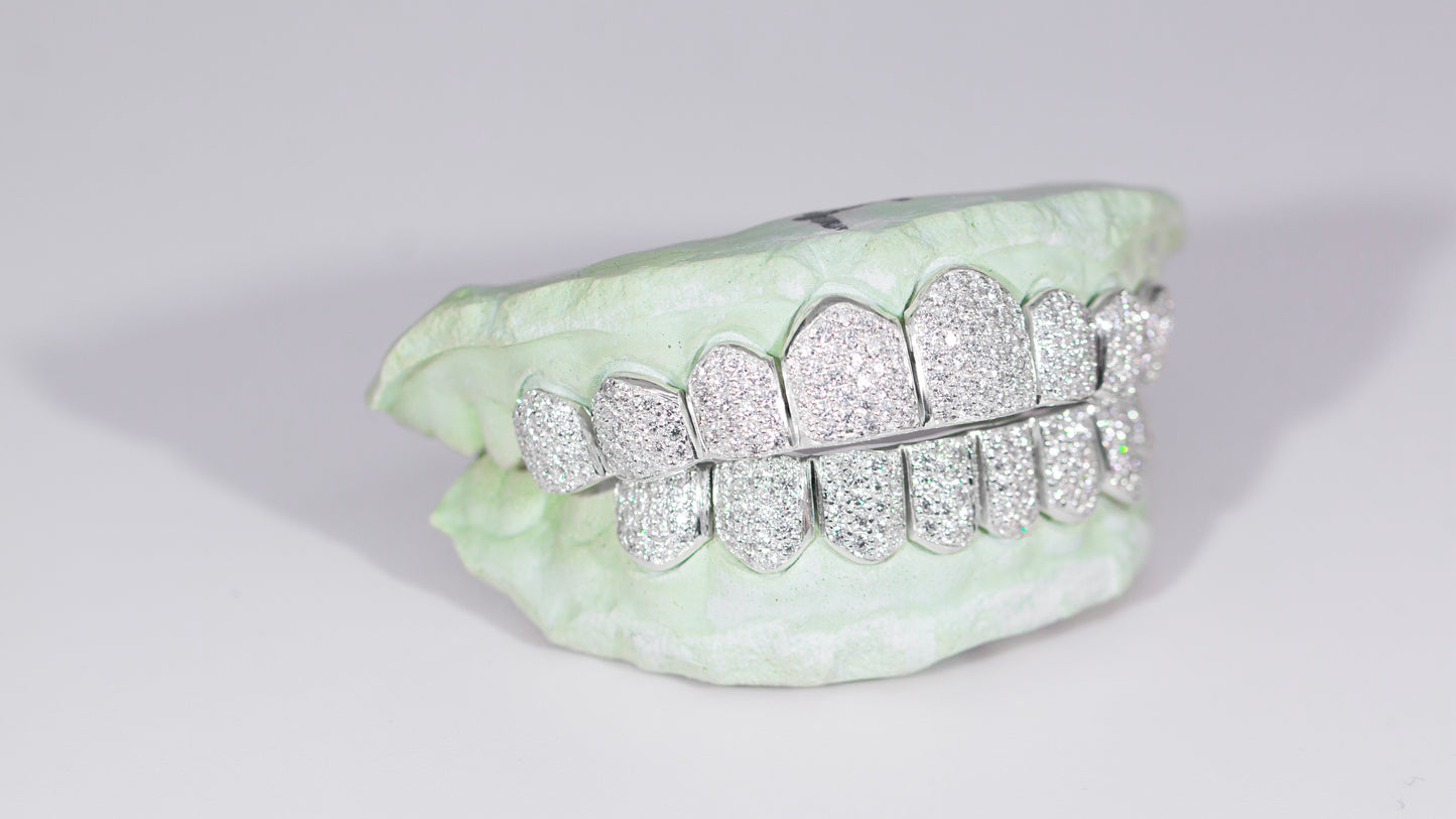 VVS MOISSANITE GRILLZ