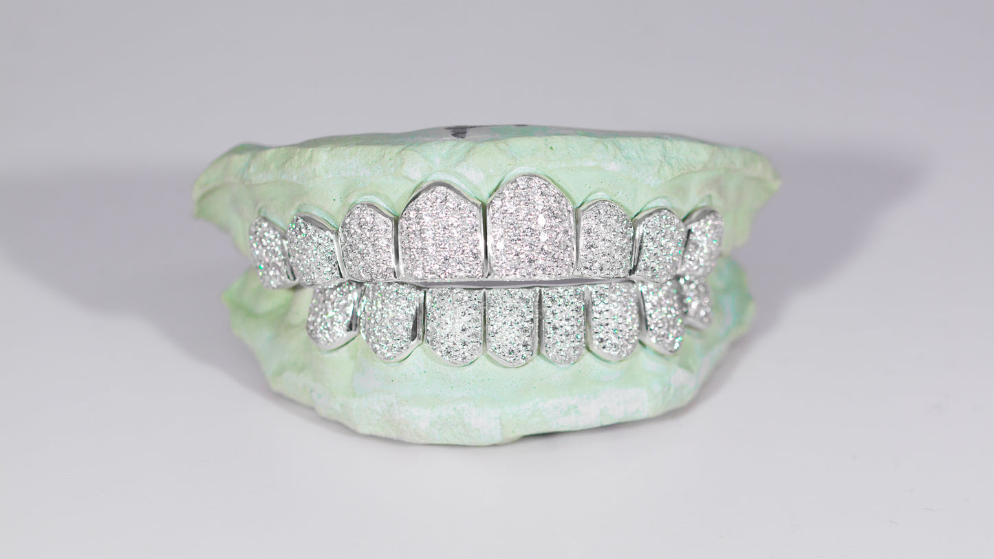 VVS MOISSANITE GRILLZ