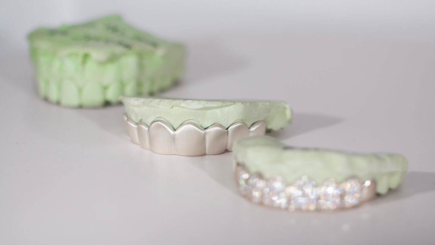 VVS Moissanite Grillz