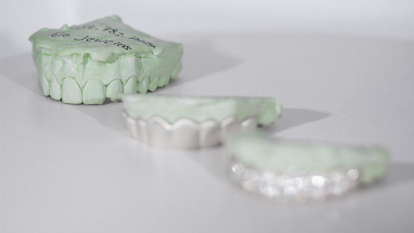 VVS MOISSANITE GRILLZ