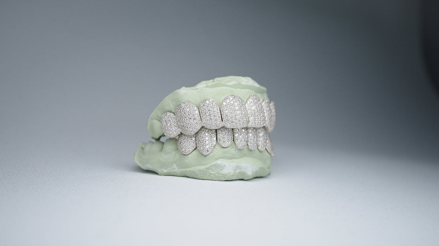 VVS Moissanite Grillz