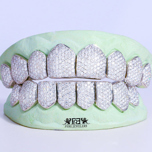 VS+ Clarity Diamond Grillz + 10kt Gold
