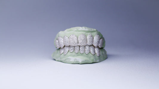 VVS Moissanite Grillz