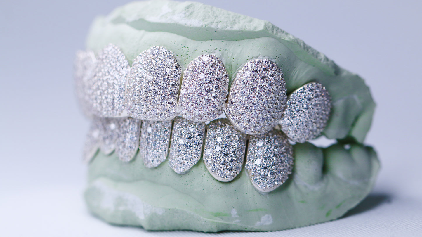 VVS Moissanite Grillz