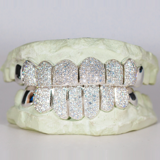 Capped Ends VVS MOISSANITE GRILLZ