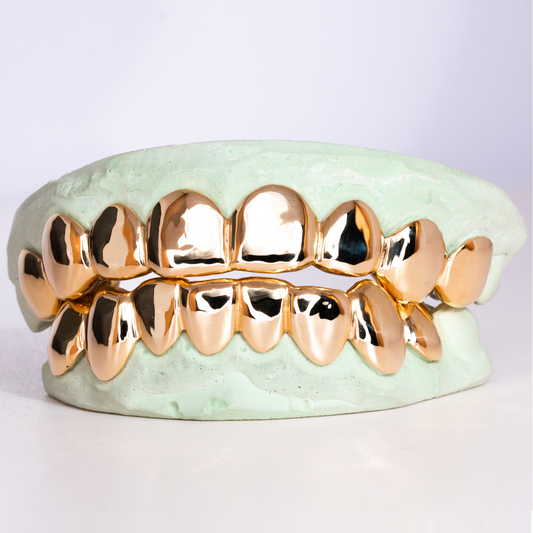 14K Gold Grillz