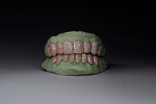 Custom Vs Clarity Diamond Grillz Hand Set Natural